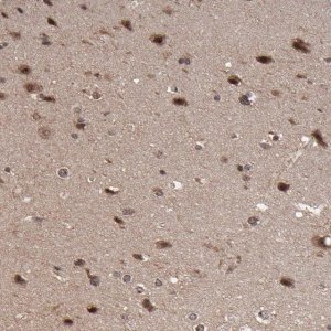 Anti-RGS6 antibody produced in rabbit 