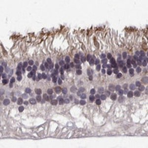 Anti-RGS9BP antibody produced in rabbit 