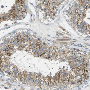 Anti-RHBDD1 antibody produced in rabbit 