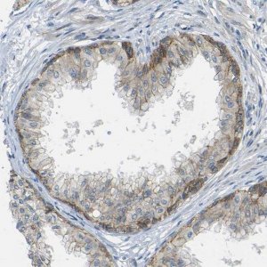 Anti-RHBDD1 antibody produced in rabbit 