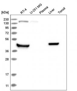Anti-RHBDL1 antibody produced in rabbit HPA030359-100UL
