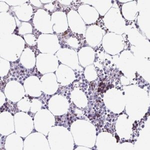 Anti-RHBDL3 antibody produced in rabbit 