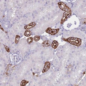 Anti-RHBG antibody produced in rabbit 