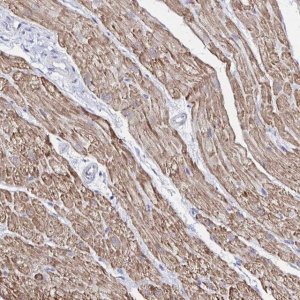 Anti-RHOBTB2 antibody produced in rabbit 