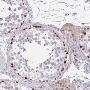 Anti-RHOXF1 antibody produced in rabbit 