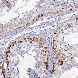 Anti-RHOXF2 antibody produced in rabbit 