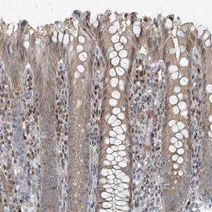 Anti-RHPN2 antibody produced in rabbit 