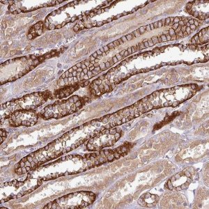 Anti-RIC1 antibody produced in rabbit 