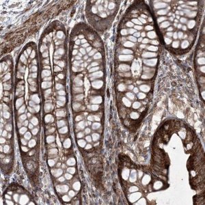 Anti-RICTOR antibody produced in rabbit 