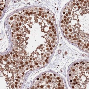Anti-RIF1 antibody produced in rabbit 