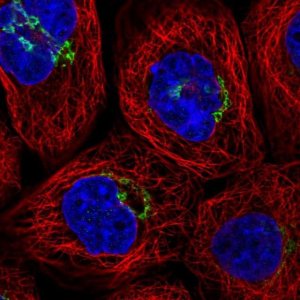 Anti-RINT1 antibody produced in rabbit 