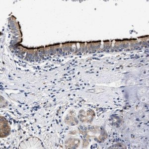Anti-RINT1 antibody produced in rabbit HPA019875-100UL