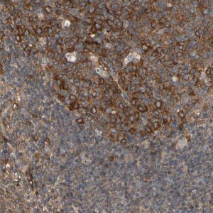 Anti-RIOK2 antibody produced in rabbit 