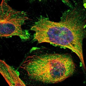 Anti-RIOK2 antibody produced in rabbit 