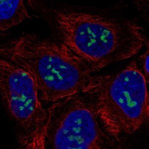 Anti-RIOX1 antibody produced in rabbit 