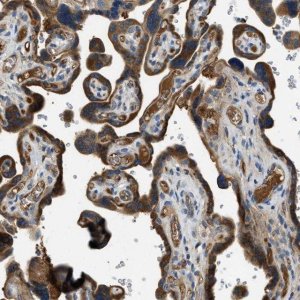 Anti-RIPK2 antibody produced in rabbit 