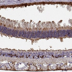 Anti-RLBP1 antibody produced in rabbit 