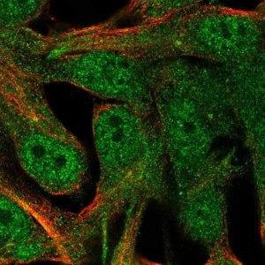 Anti-RLBP1 antibody produced in rabbit 