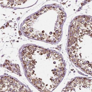 Anti-RMDN3 antibody produced in rabbit 