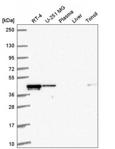 Anti-RMND5A antibody produced in rabbit 