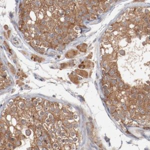 Anti-RNASE11 antibody produced in rabbit 