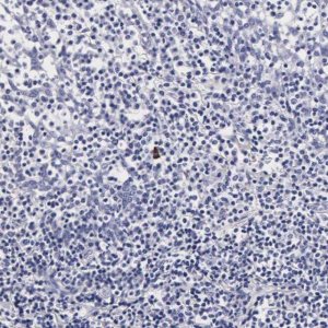 Anti-RNASE6 antibody produced in rabbit 