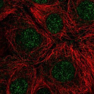 Anti-RNASEH2C antibody produced in rabbit 