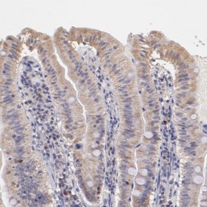 Anti-RNASEL antibody produced in rabbit 