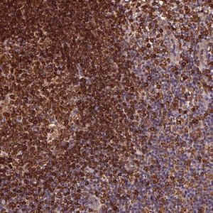Anti-RNASET2 antibody produced in rabbit 
