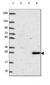 Anti-RNASET2 antibody produced in rabbit 