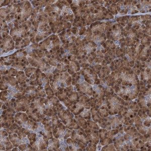 Anti-RNF125 antibody produced in rabbit 