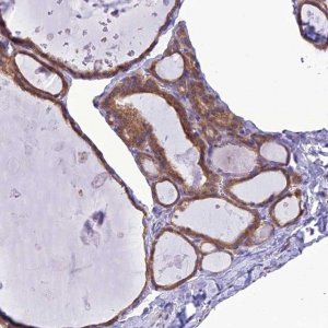Anti-RNF126 antibody produced in rabbit 