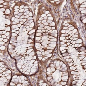 Anti-RNF128 antibody produced in rabbit 