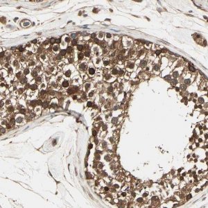 Anti-RNF14 antibody produced in rabbit 