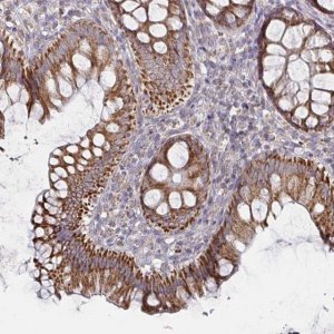 Anti-RNF144B antibody produced in rabbit 