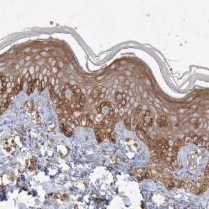 Anti-RNF145 antibody produced in rabbit 