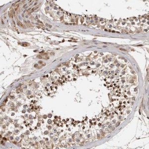 Anti-RNF157 antibody produced in rabbit 