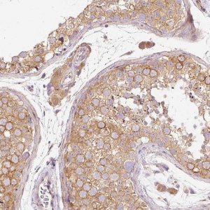Anti-RNF167 antibody produced in rabbit 