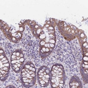 Anti-RNF170 antibody produced in rabbit 