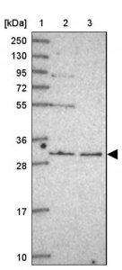 Anti-RNF170 antibody produced in rabbit 