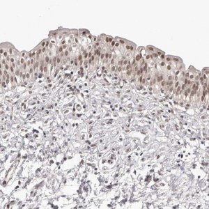 Anti-RNF2 antibody produced in rabbit 