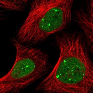 Anti-RNF2 antibody produced in rabbit 