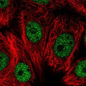 Anti-RNF208 antibody produced in rabbit 