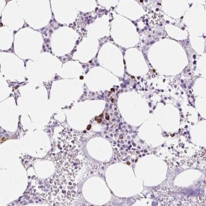 Anti-RNF212B antibody produced in rabbit 