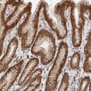 Anti-RNF213 antibody produced in rabbit 