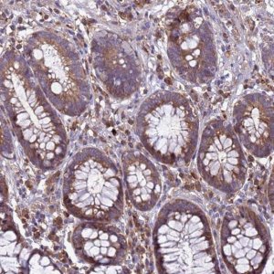 Anti-RNF215 antibody produced in rabbit 