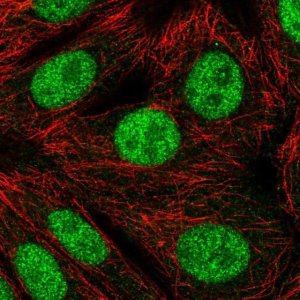 Anti-RNF220 antibody produced in rabbit 
