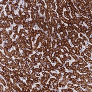 Anti-RNF222 antibody produced in rabbit 