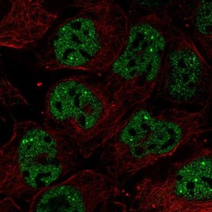 Anti-RNF34 antibody produced in rabbit 