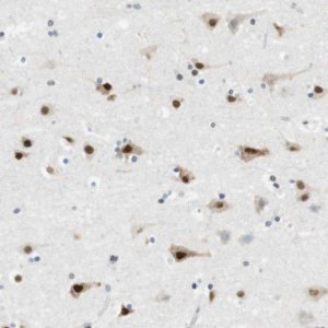 Anti-RNF38 antibody produced in rabbit 
